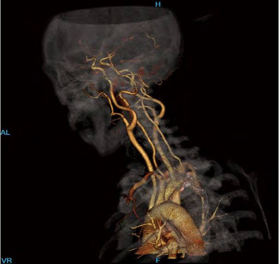 InsitumCT 16/32 a 16/32 Slice CT scanner - Image 2