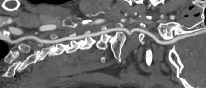 InsitumCT 16/32 a 16/32 Slice CT scanner - Image 3