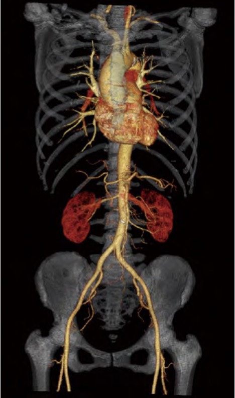 InsitumCT 16/32 a 16/32 Slice CT scanner - Image 4